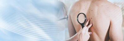Dr. med Katharina Schwede Praxis für Haut- und Geschlechtskrankheiten, Phlebologie und Allergologie