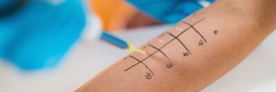Klinik und Poliklinik für Dermatologie, Venerologie und Allergologie