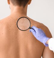 Dermatologie