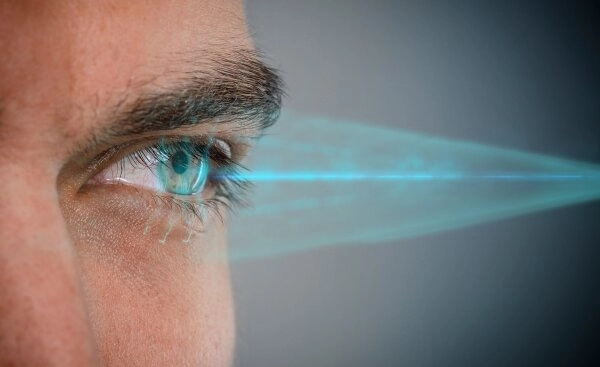 Augenlasern