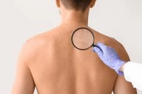Dermatologie