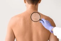 Dermatologie