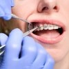 Logo O+ Oralchirurgieplus Dr. med. dent. Guido H. Kemp