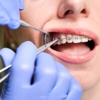 Logo Praxis Ates - Fachzahnarztpraxis für Oralchirurgie